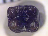 primate molar